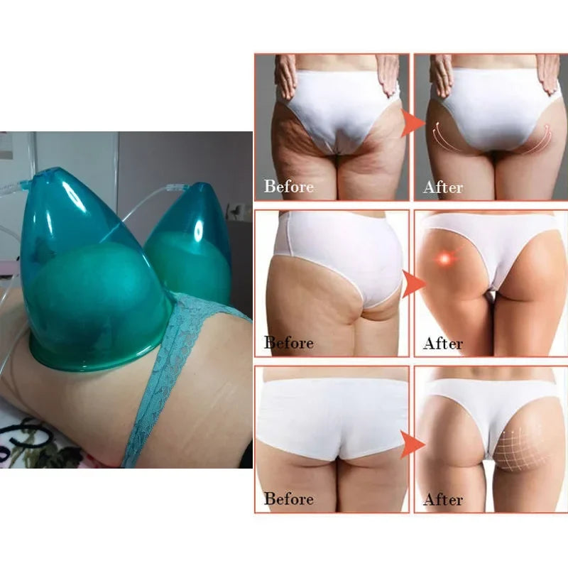 Body Sculpting Cups - 6pcs Silicone Vacuum Therapy Set for Breast/Butt Lifting, Lymphatic Drainage & Skin Tightening (BBL Massag